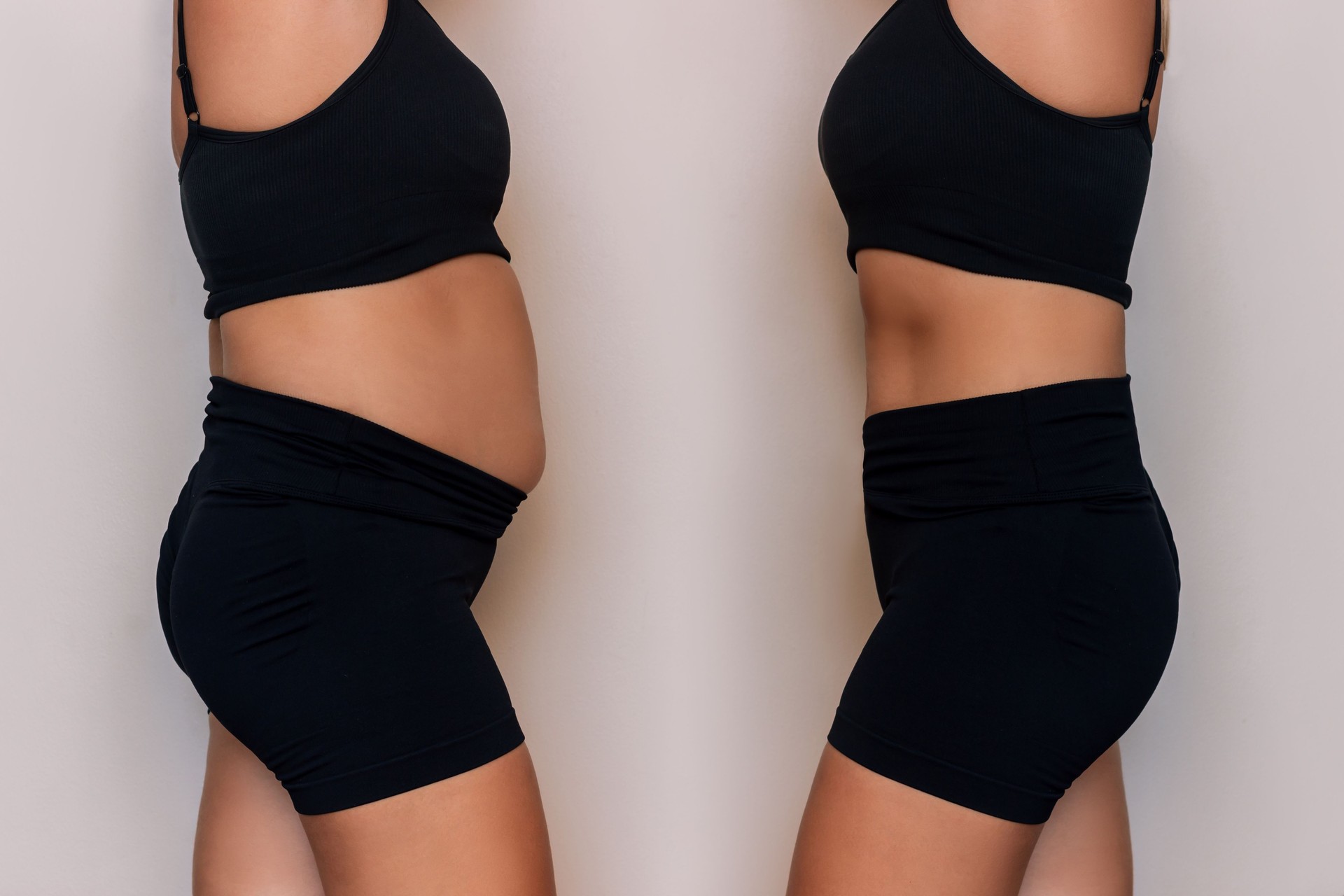 Woman in a black sportswear with a fat belly and toned slim abdomen before and after losing weight